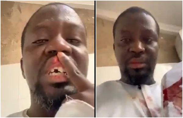 Ibrahim Mahama disputes police account over alleged “Black Maria” attack