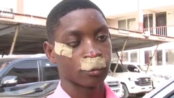 VIDEO: Obrachire SHS Student Speaks Out After Brutal Assault During Inter‑School Sports